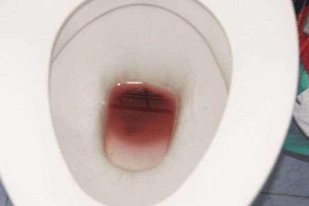 spots when excited in men